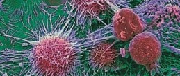 Медики выяснили, почему возвращаются раковые опухоли
